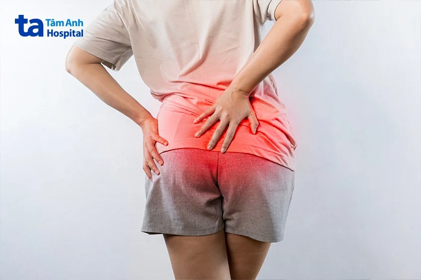 dấu hiệu của bệnh trĩ ở phụ nữ
